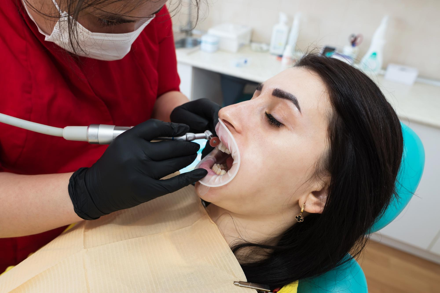 cosmetic bonding cosmetic bonding