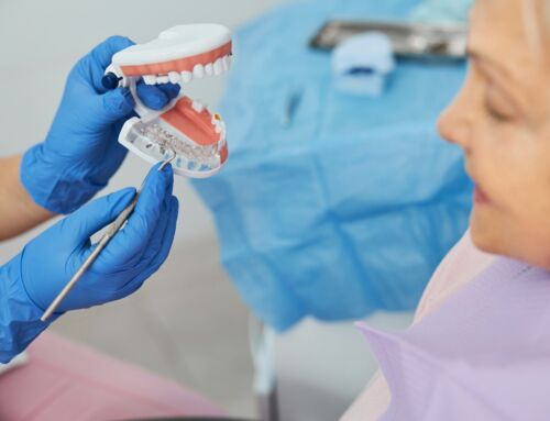 Preventing Dental Implant Infections: What You Need To Know