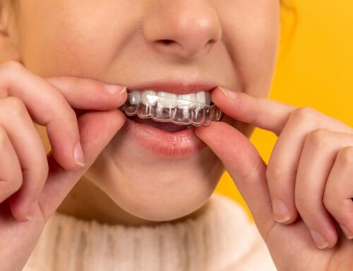 When To Consult Your Dentist About Invisalign Issues