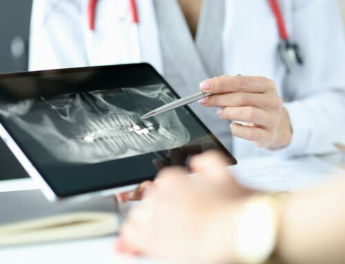 Maintaining Dental Implants During The Winter Months