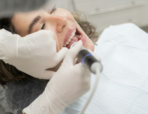 Composite Bonding: Addressing Uneven Teeth in Timperley