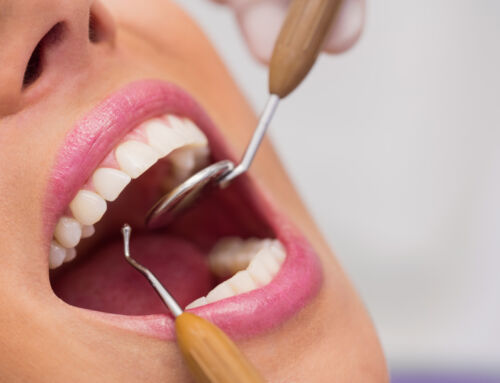 Cosmetic Dentistry in Woodford Your Guide to Smile Options