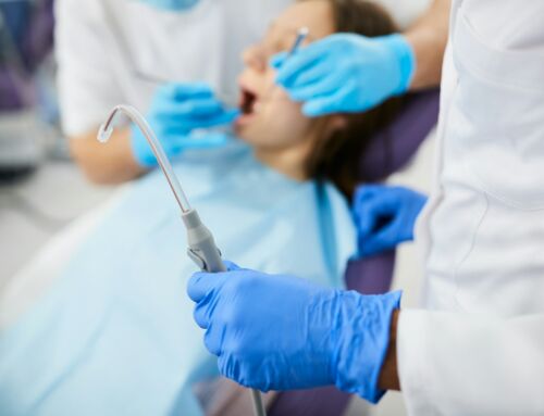 Understanding Dental Composite Bonding for Minor Tooth Flaws
