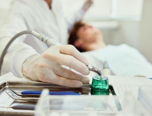 Dental Implants in Alderley Edge What Recovery Is Really Like